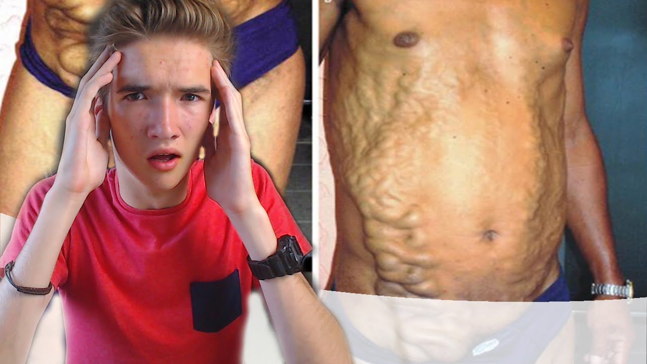 10 MEEST DODELIJKE ZIEKTES TER WERELD! - YouTube - Metabole Ziekte Wat Is Dat