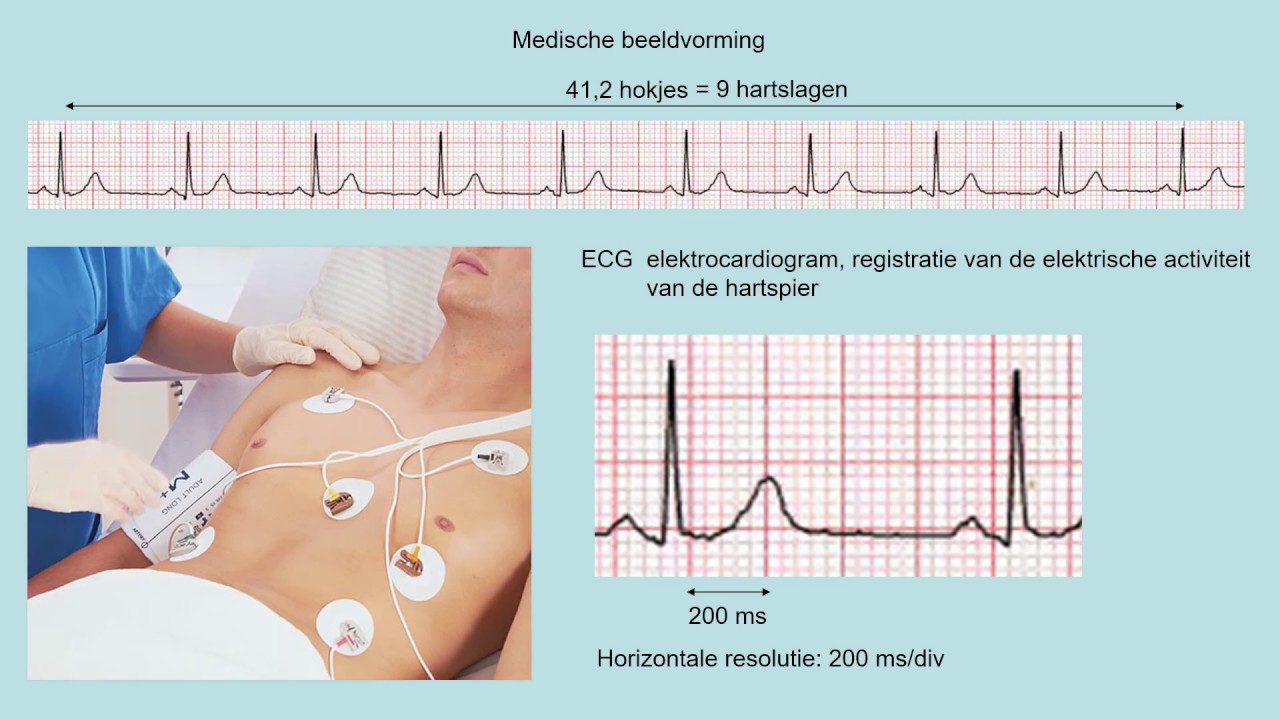 Medische Beeldvorming En Radiotherapeutische Technieken