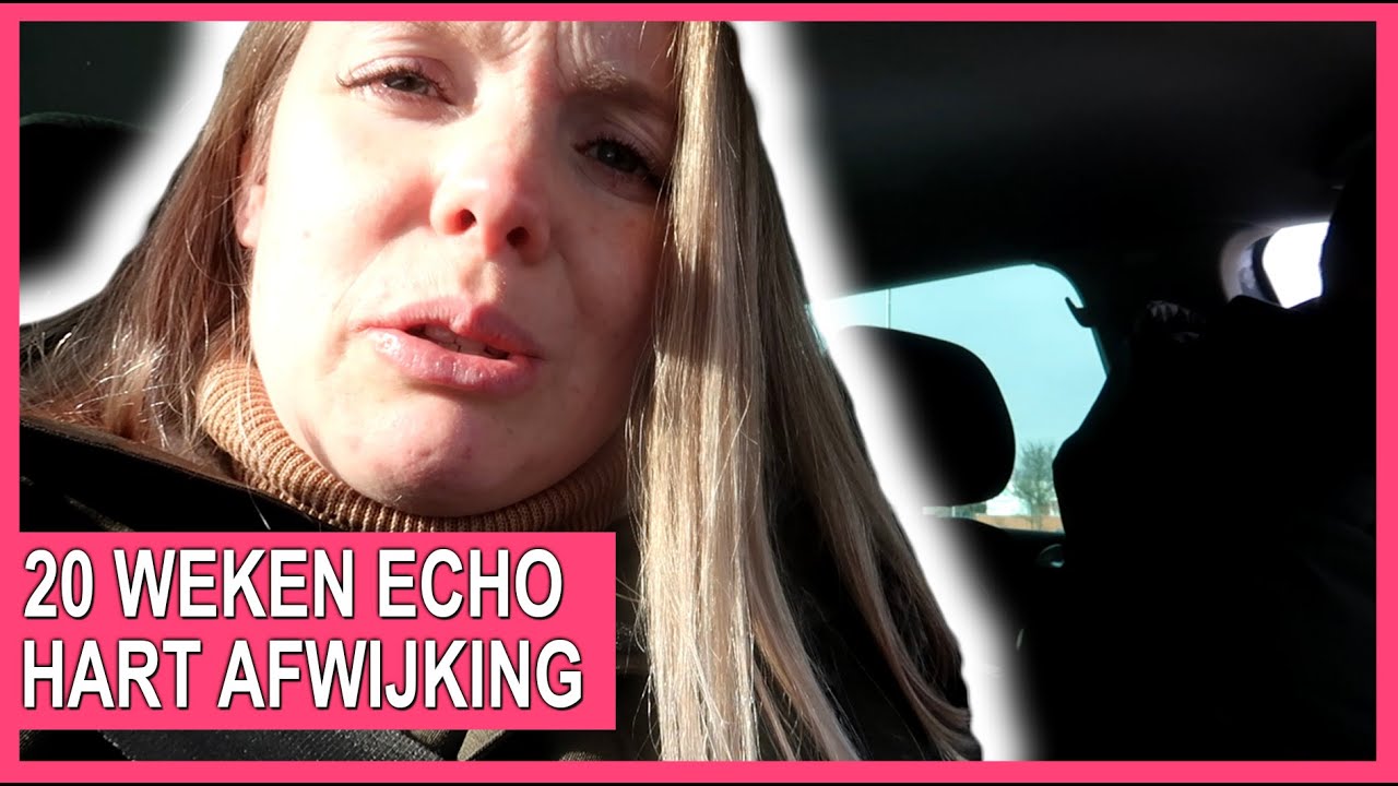 20 WEKEN ECHO, HARTAFWIJKING? | TiVie | WEEKVLOG #81 - YouTube - Hartafwijking Baby 20 Weken Echo