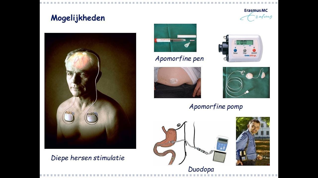 3e Lijns therapieen - YouTube - 1e Lijns 2e Lijns 3e Lijns Zorg