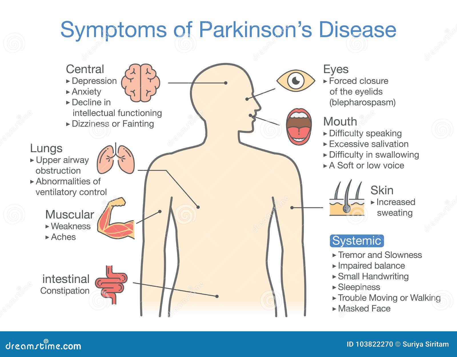 Wat Is Erger Parkinson Of Parkinsonisme