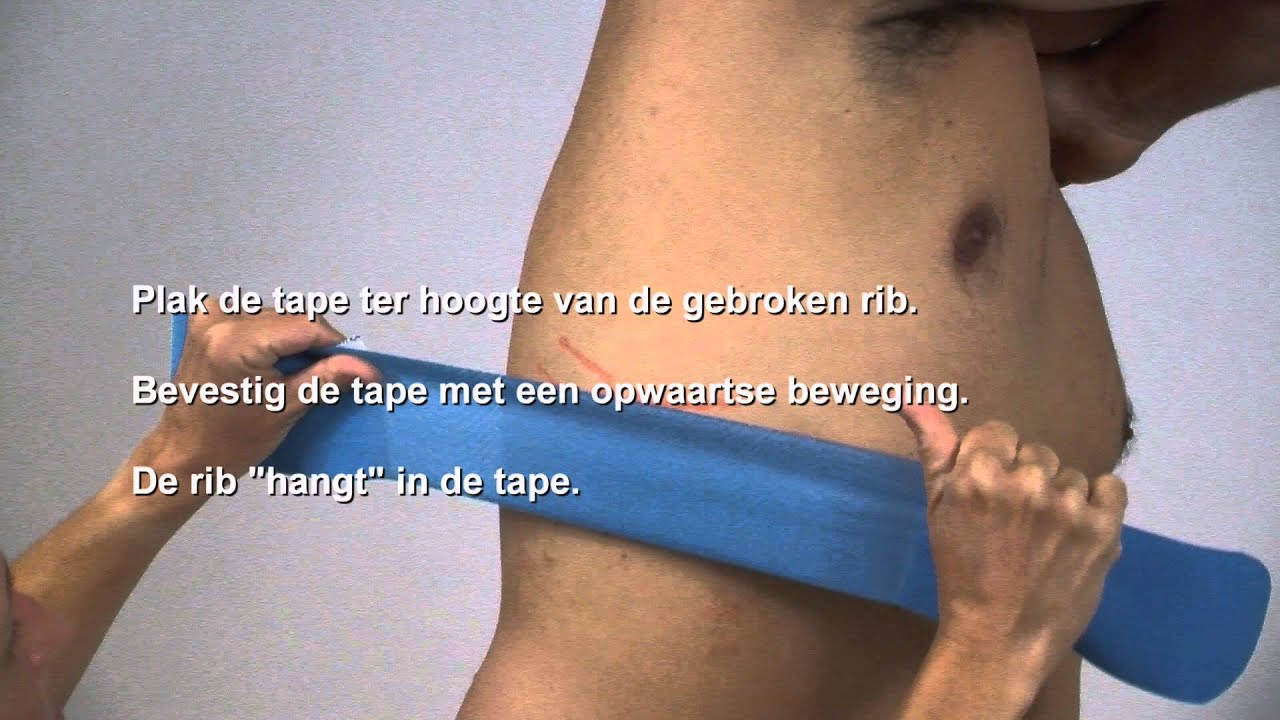 Aanbrengen van tape bij een gebroken rib - YouTube - Wat Zit Onder Je Ribben
