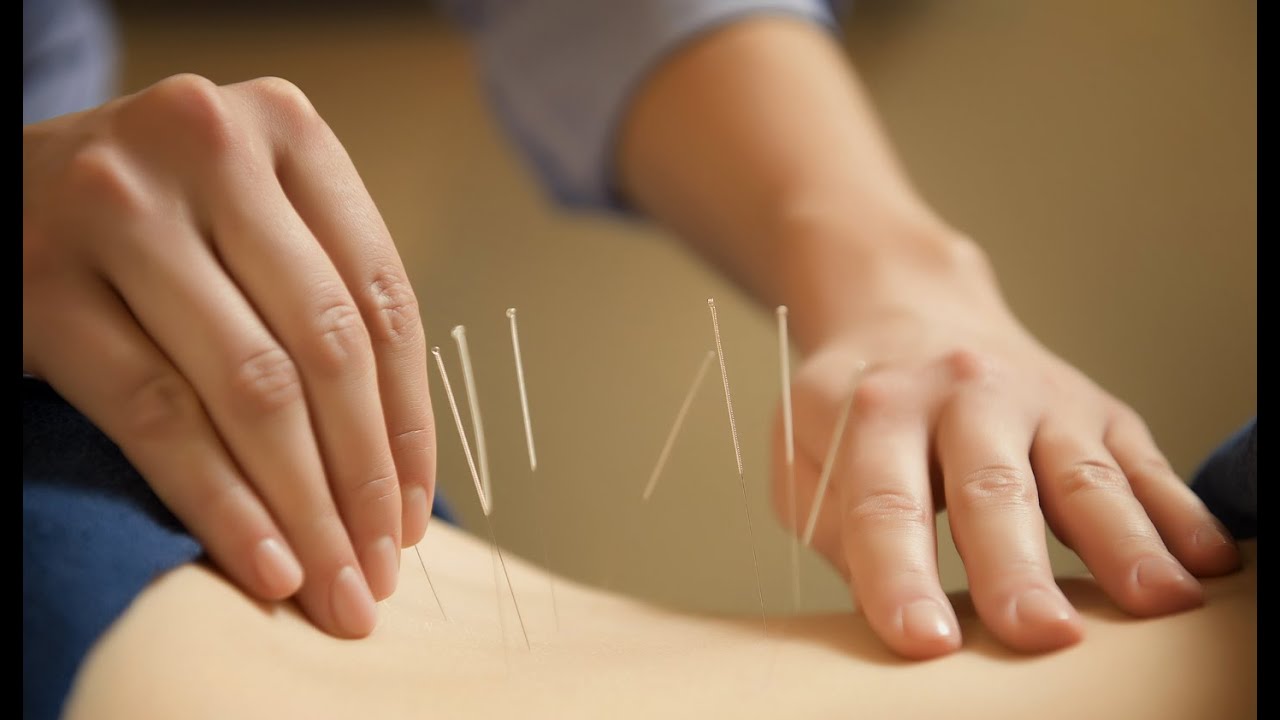 Waarmee Werkt Iemand Die Acupunctuur Beoefend
