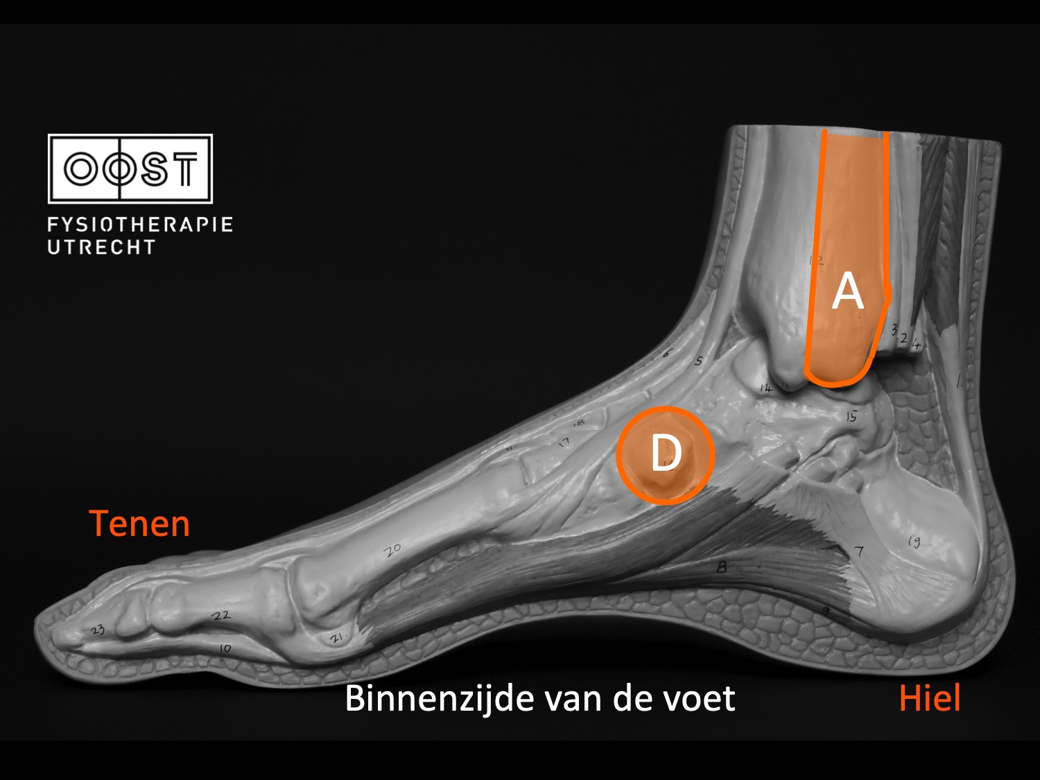 Acute pijn of zwelling van je enkel - Fysiotherapie Utrecht Oost - Hoe Lang Ijs Op Zwelling