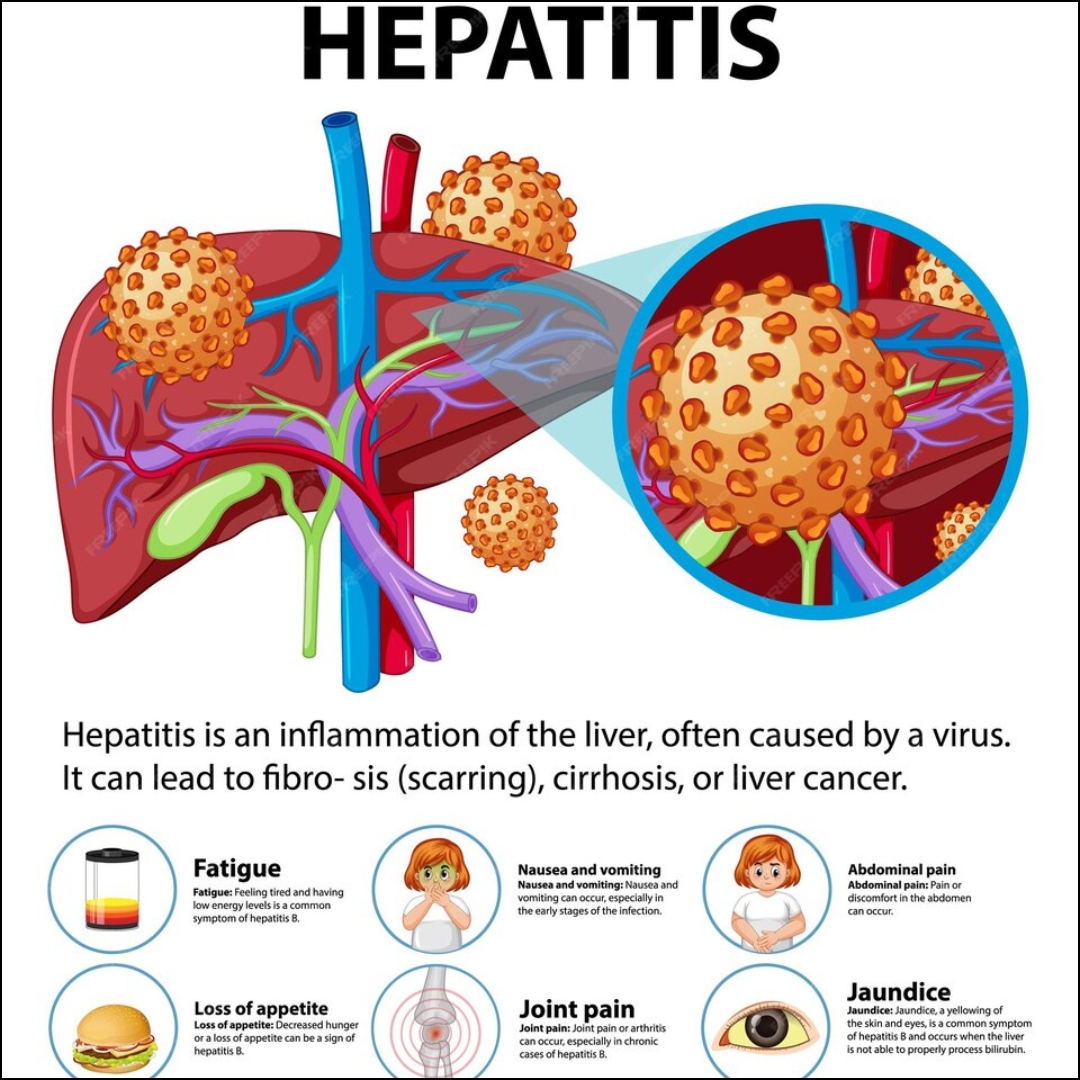 All you need to know about Hepatitis - Hepatitis B Hoe Krijg Je Dat