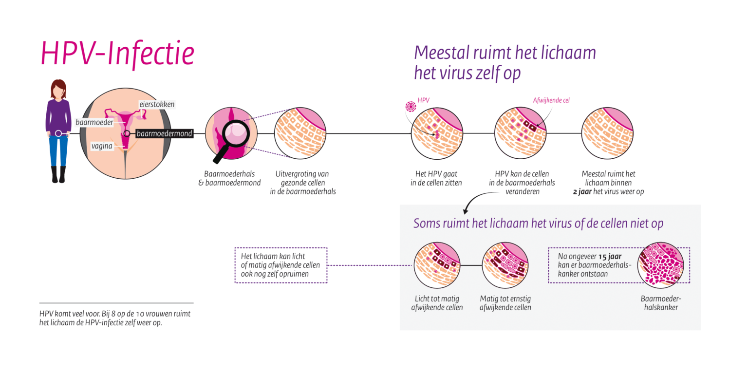 Tot Welke Leeftijd Baarmoederhalskanker Onderzoek