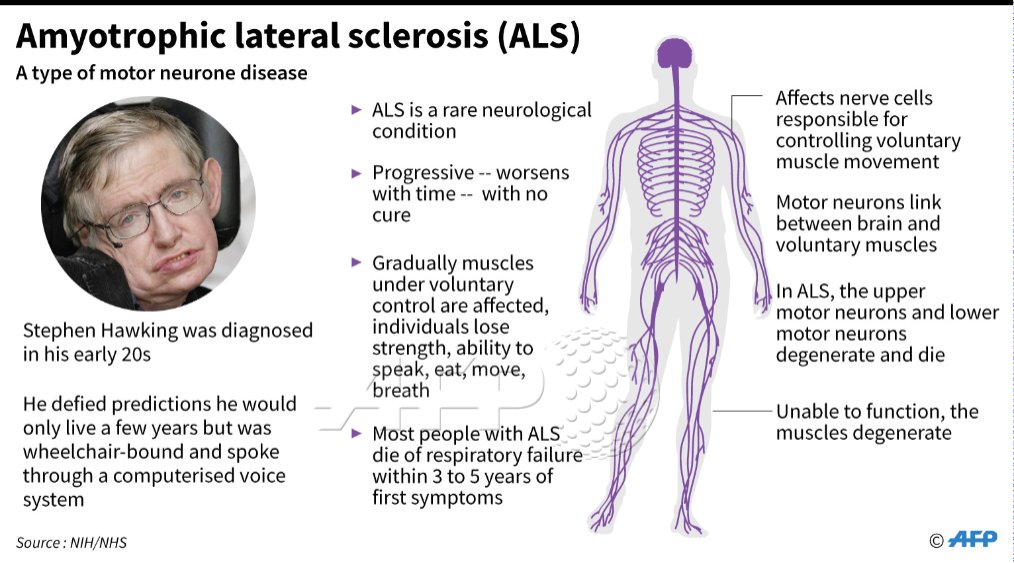 ALS: The disease that Stephen Hawking defied for decades – BorneoPost - Als De Ene Blinde De Andere Leidt