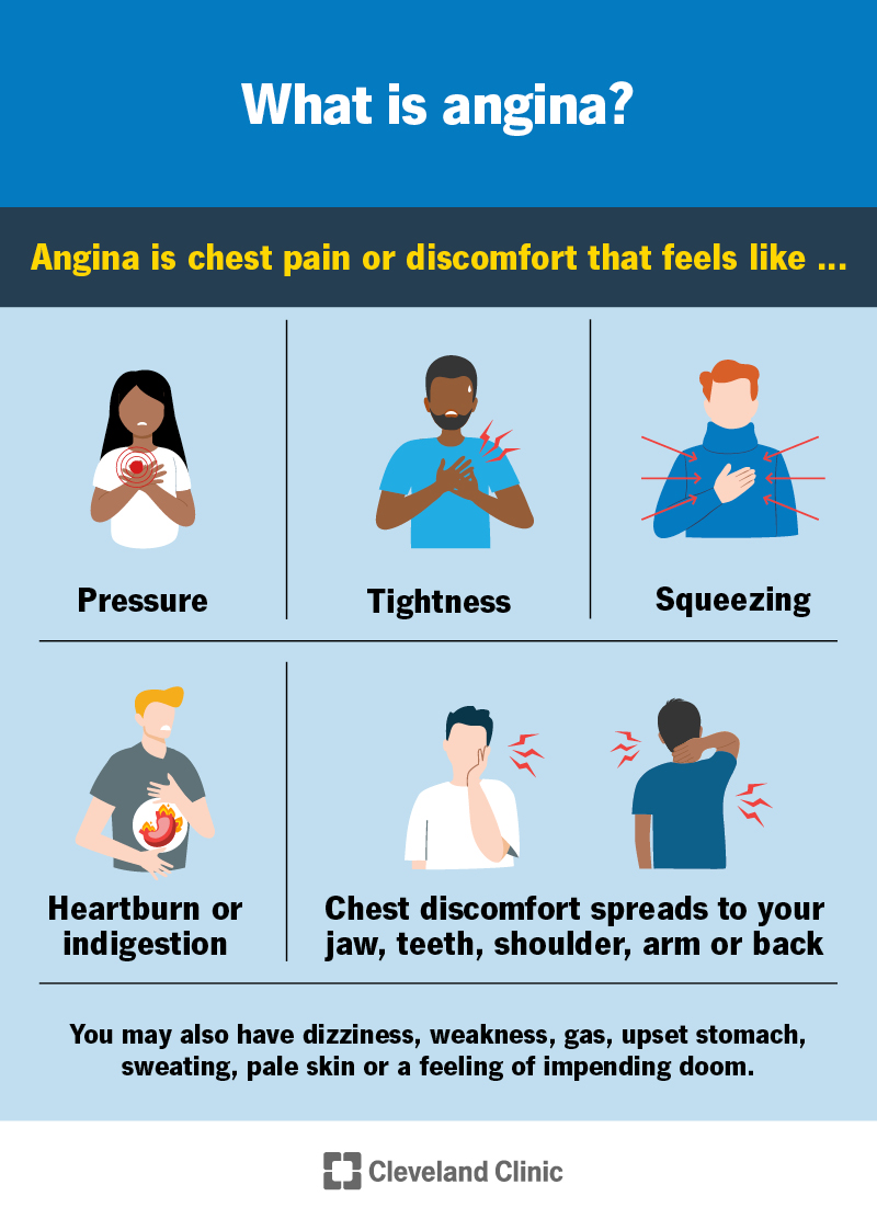 Angina: Symptoms, Causes & Treatment - Angina Pectoris Hartaanval Waarschuwingen Symptomen Hartaanval