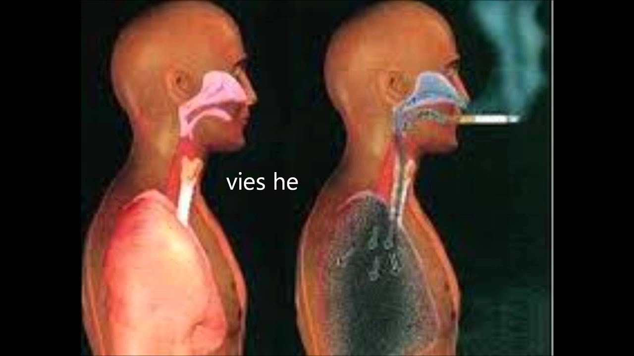 anti roken - YouTube - Waarom Is Roken Slecht Voor Je