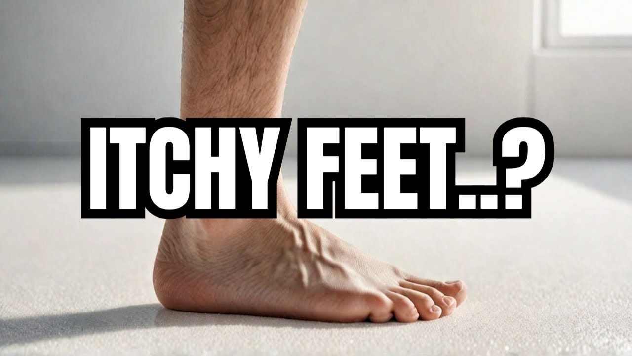 Athlete's Foot! (- A Tinea pedis Infection) - YouTube - Creators Are The New Athletes