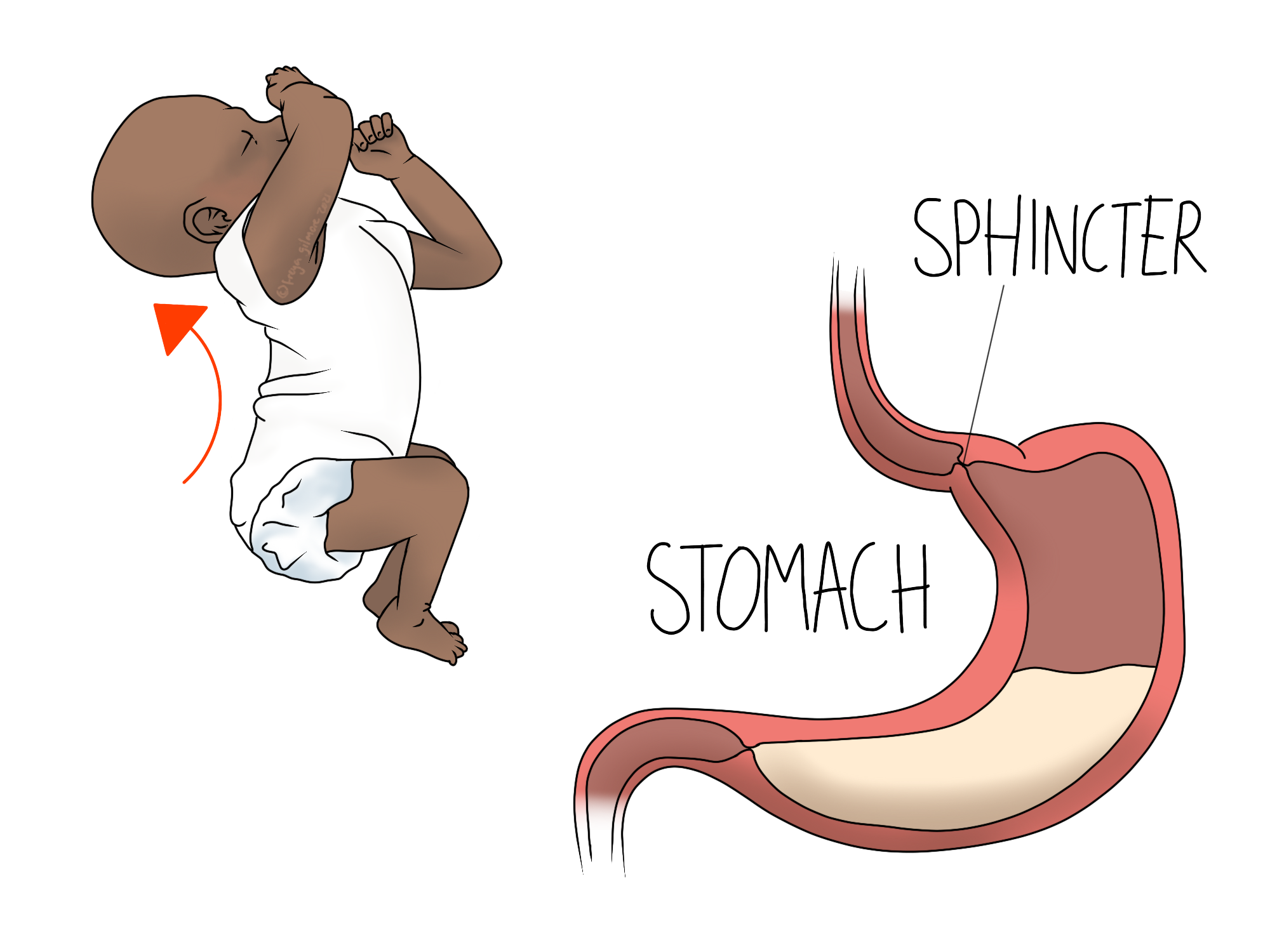Baby Reflux - Beth Forrest Osteopathy - Welke Voeding Bij Reflux Baby