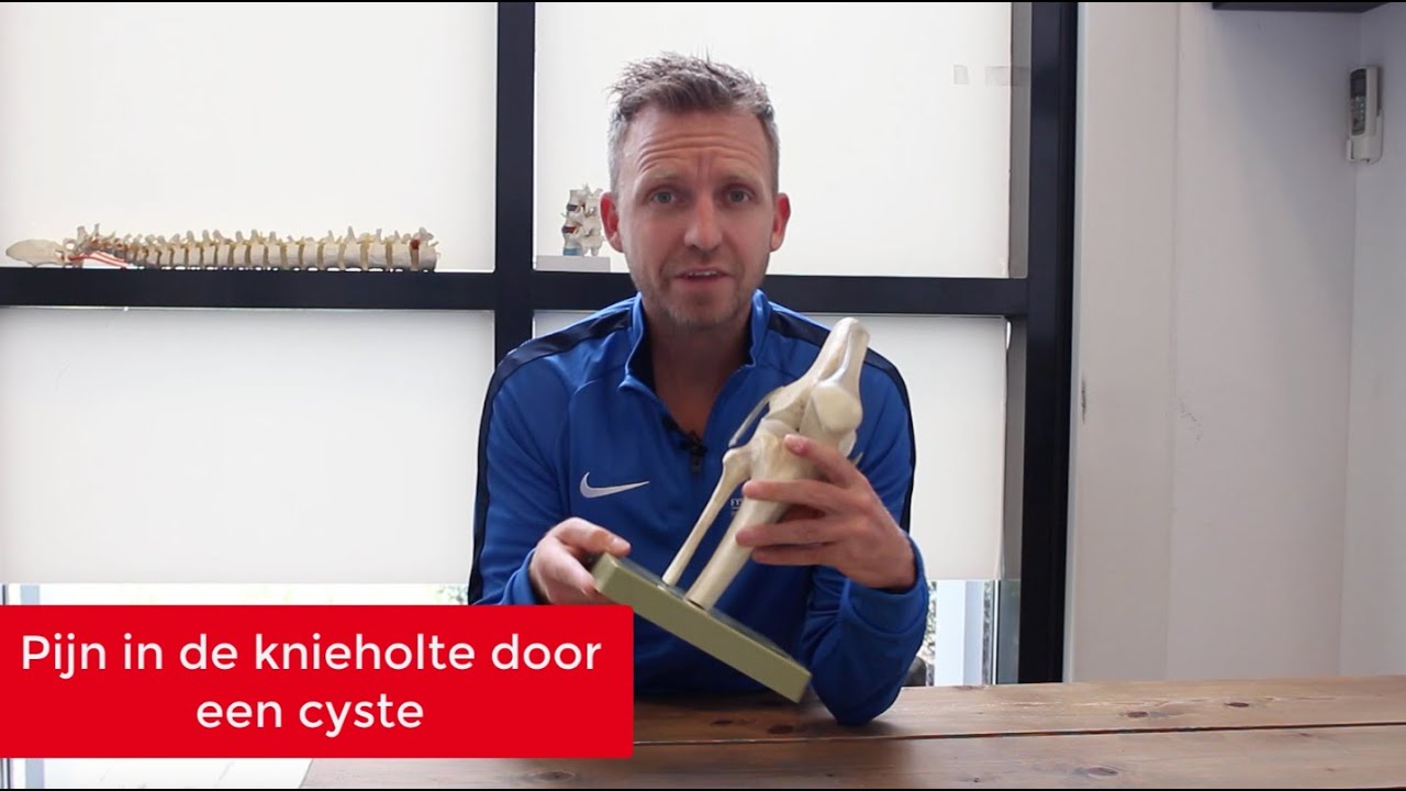 Bakers cyste - Pijn in je knieholte? - YouTube - Doet Een Kwaadaardige Knobbel Pijn