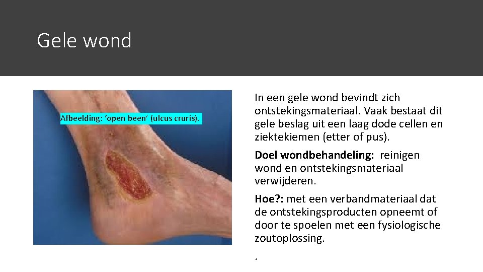 Behandelen Wondverzorging MTH voor DA H 6 22 - Wat Is Een Gele Wond