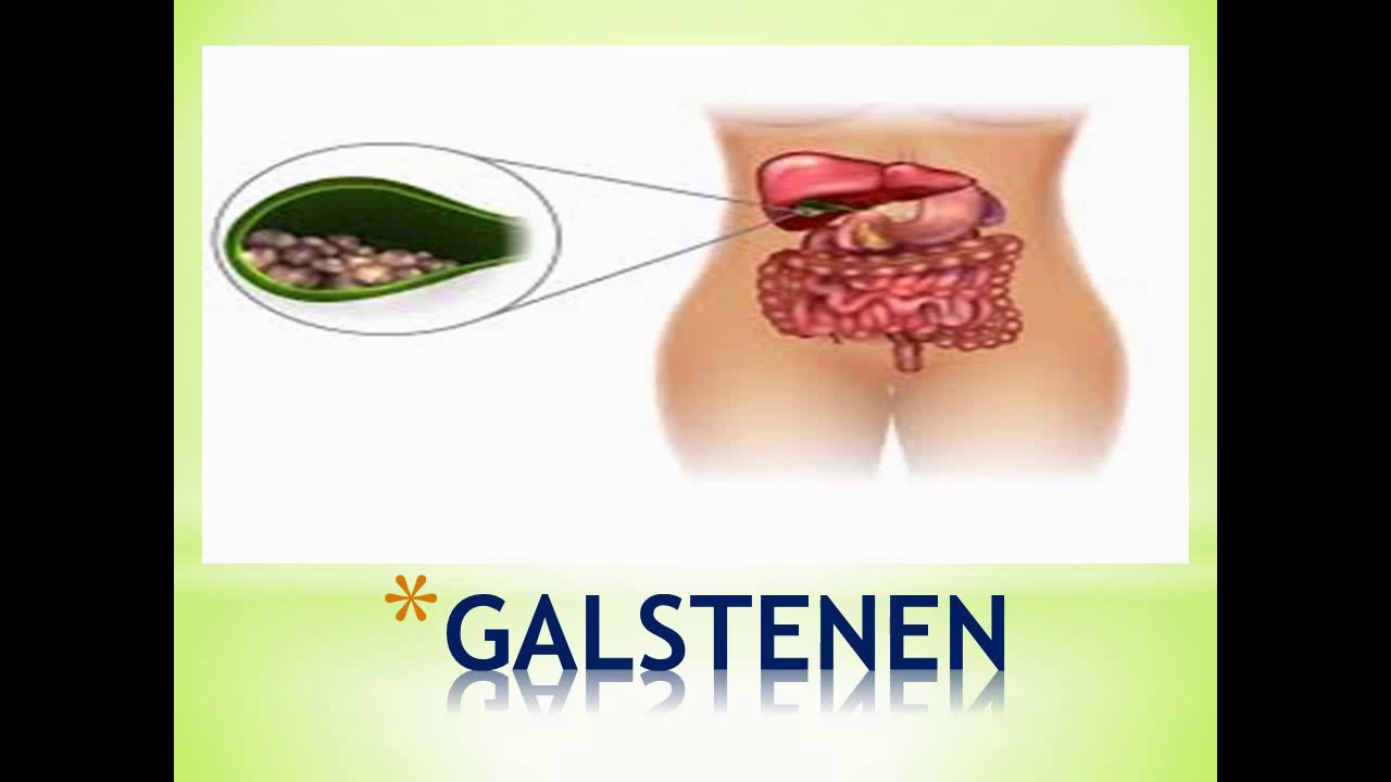 BEPROEFDE GENEESMIDDELEN UIT GROOTMOEDERS TIJD (GALSTENEN) - YouTube - Uit Welke Substantie Bestaan Galstenen Vooral