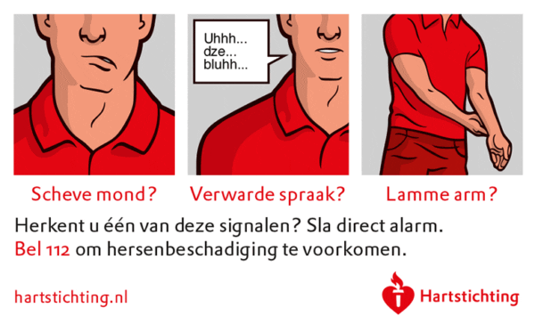 Beroerte (CVA) | HMC - Hoe Herken Je Een Cva