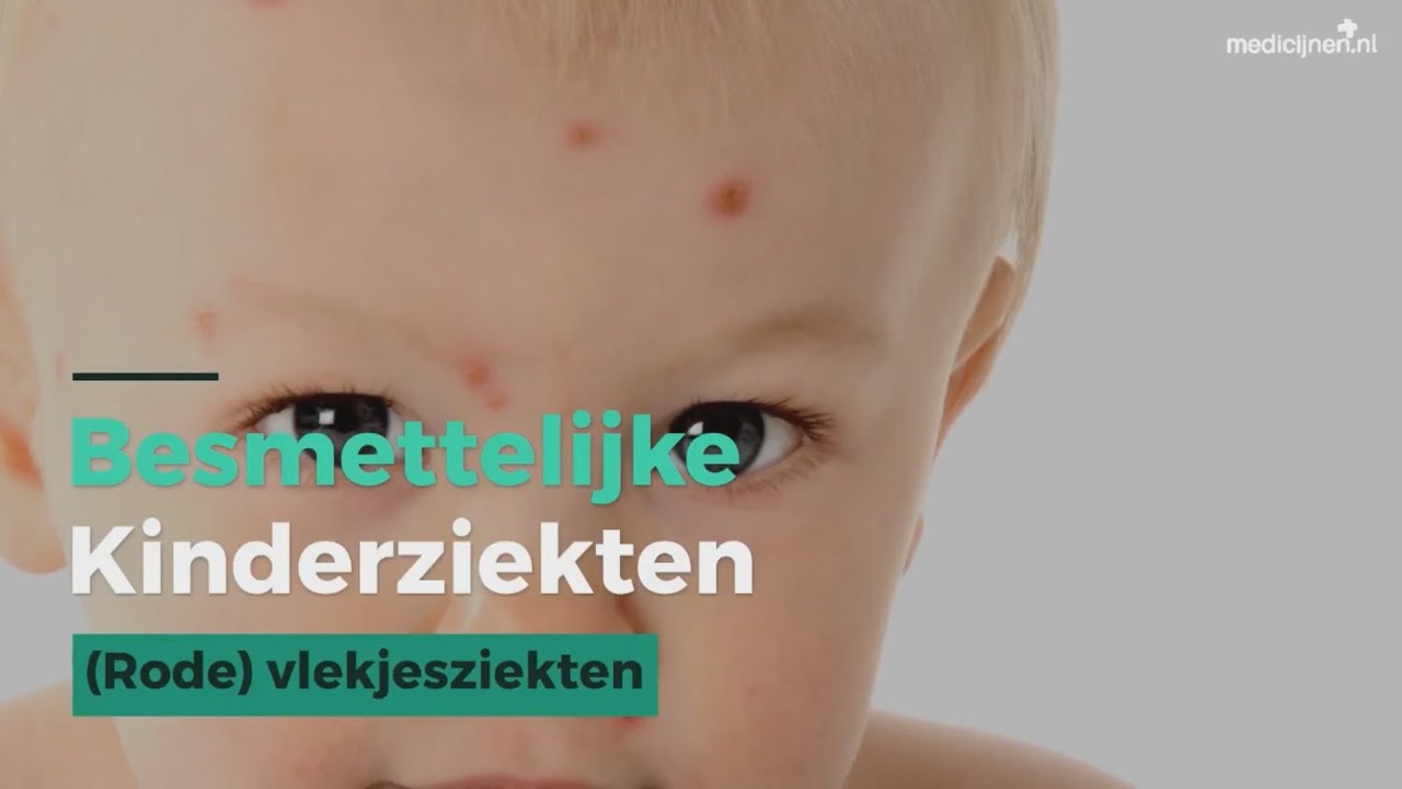 Besmettelijke kinderziekten - YouTube - Na Hoeveel Dagen Koortslip Niet Besmettelijk