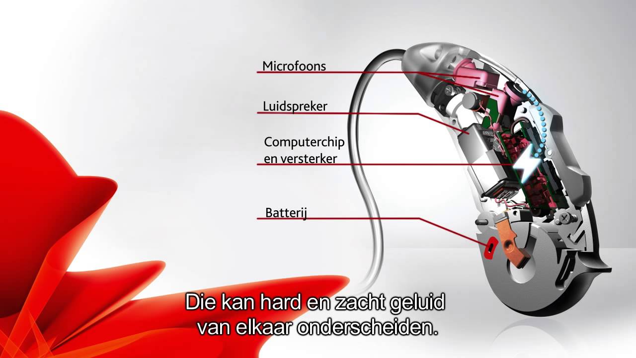 Beter Horen - Werking van het hoortoestel - YouTube - Gaat Geluid Omhoog Of Omlaag