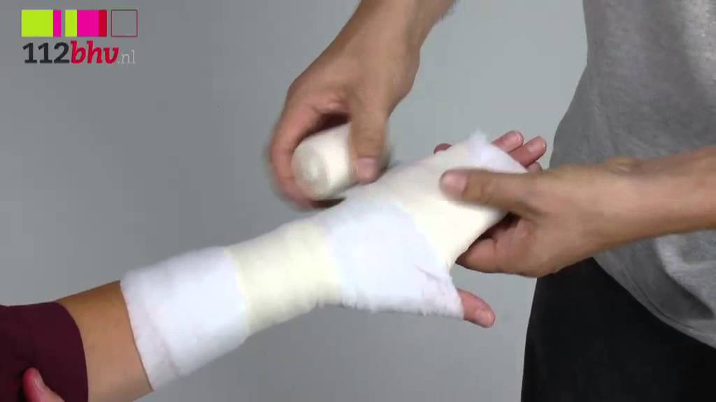 Hoe Weet Je Of Je Vinger Gebroken Is