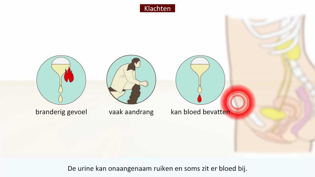 Blaasontsteking - Oorzaak en behandeling - YouTube - Hoe Lang Blijft Koolmonoxide In Je Bloed