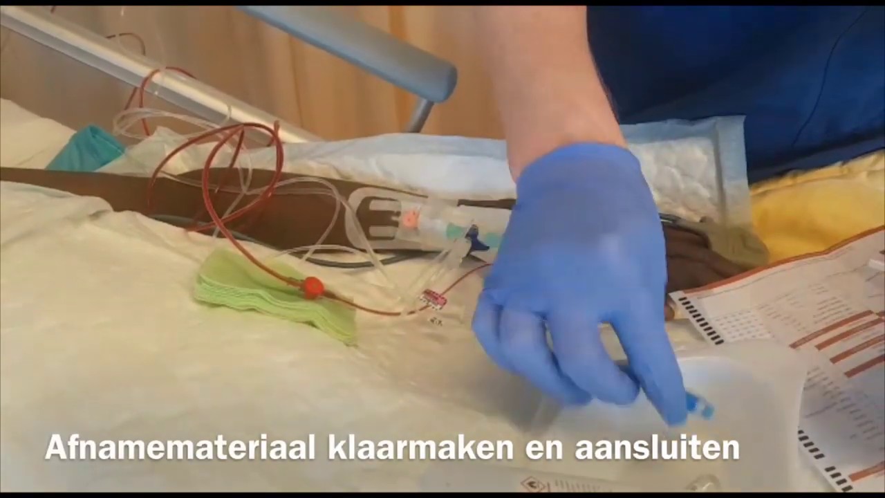 Bloedafname vanuit arterielijn - YouTube - Wat Is Een Picc Lijn