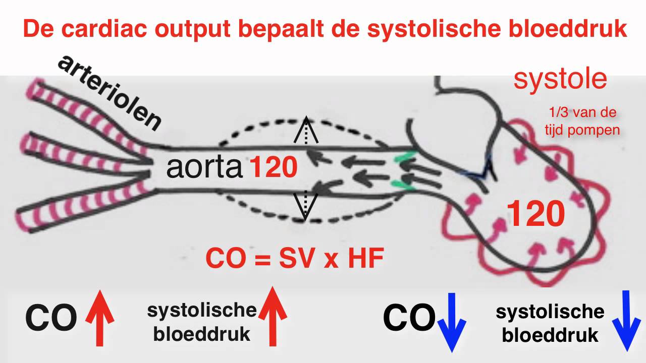 Bloeddruk Verschil Links Rechts Aneurysma