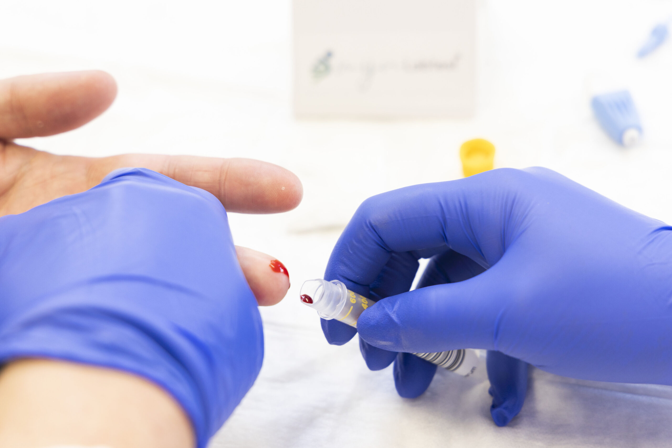 Bloedonderzoek - Healthcare Assist - Bloedonderzoek Alat Wat Is Dat