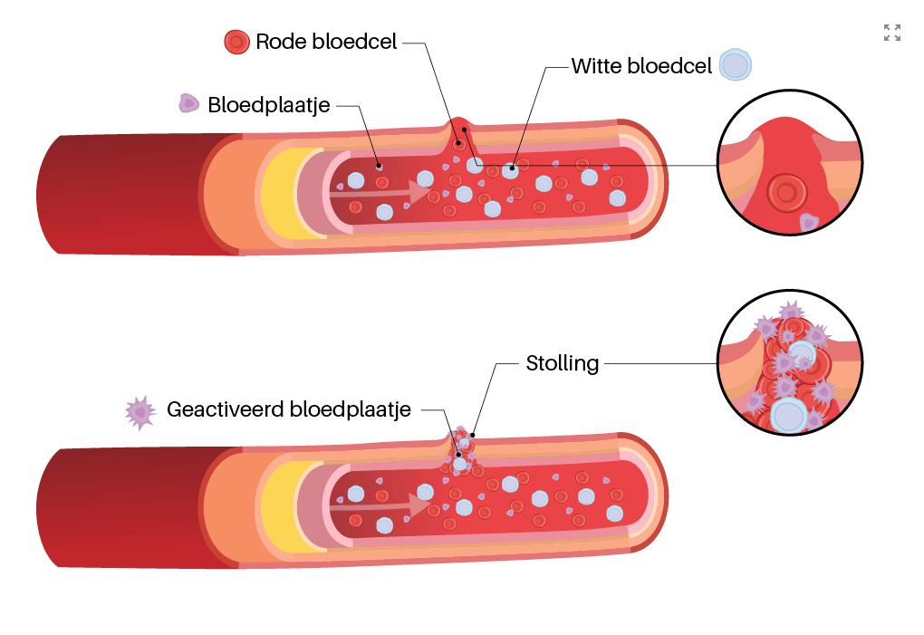Bloedplaatjes doneren bij de bloedbank | Sanquin - Hoeveel Bloed Heb Je In Je Lichaam
