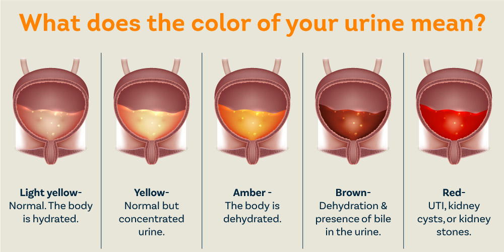 Blood Drops Urine Male Hotsell | laseb.fae.ufmg.br - Bloed Bij Urine Man Oorzaak