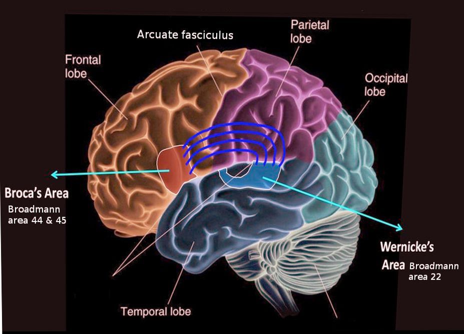 Broca’s area, located in the left hemisphere, is associated - MEDizzy - Gebied Van Broca En Wernicke
