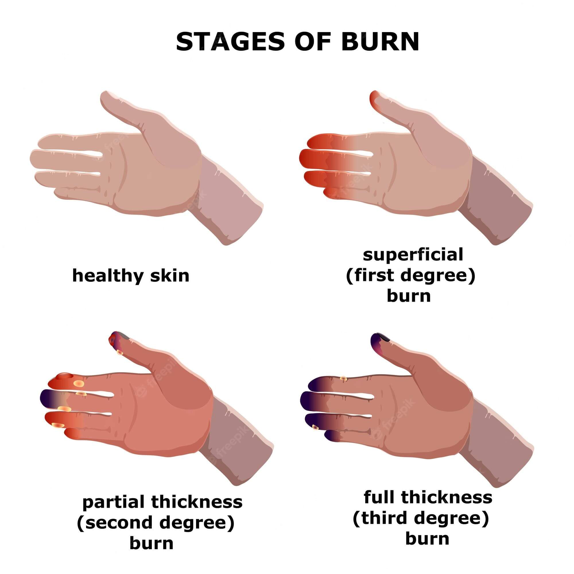 Burn Out Of Bore Out