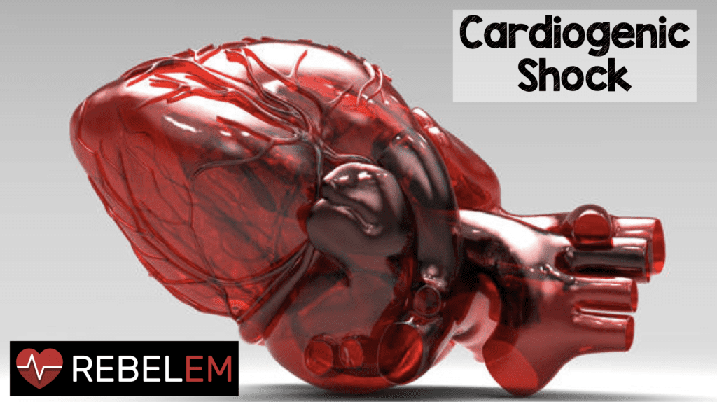 Cardiogenic Shock - REBEL EM - Emergency Medicine Blog - Shock Mel Wallis De Vries