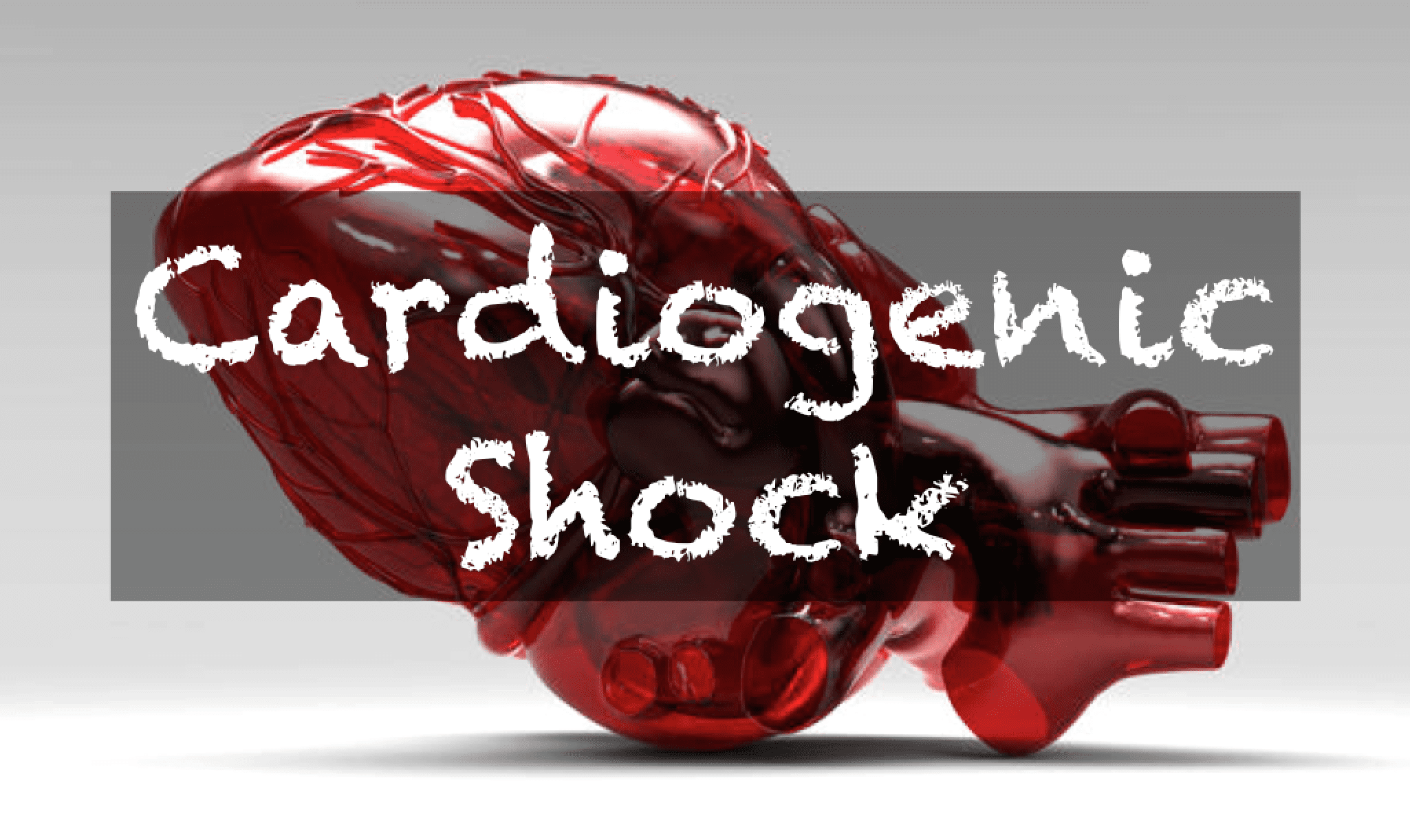 Cardiogenic Shock - REBEL EM - Emergency Medicine Blog - Shock Mel Wallis De Vries