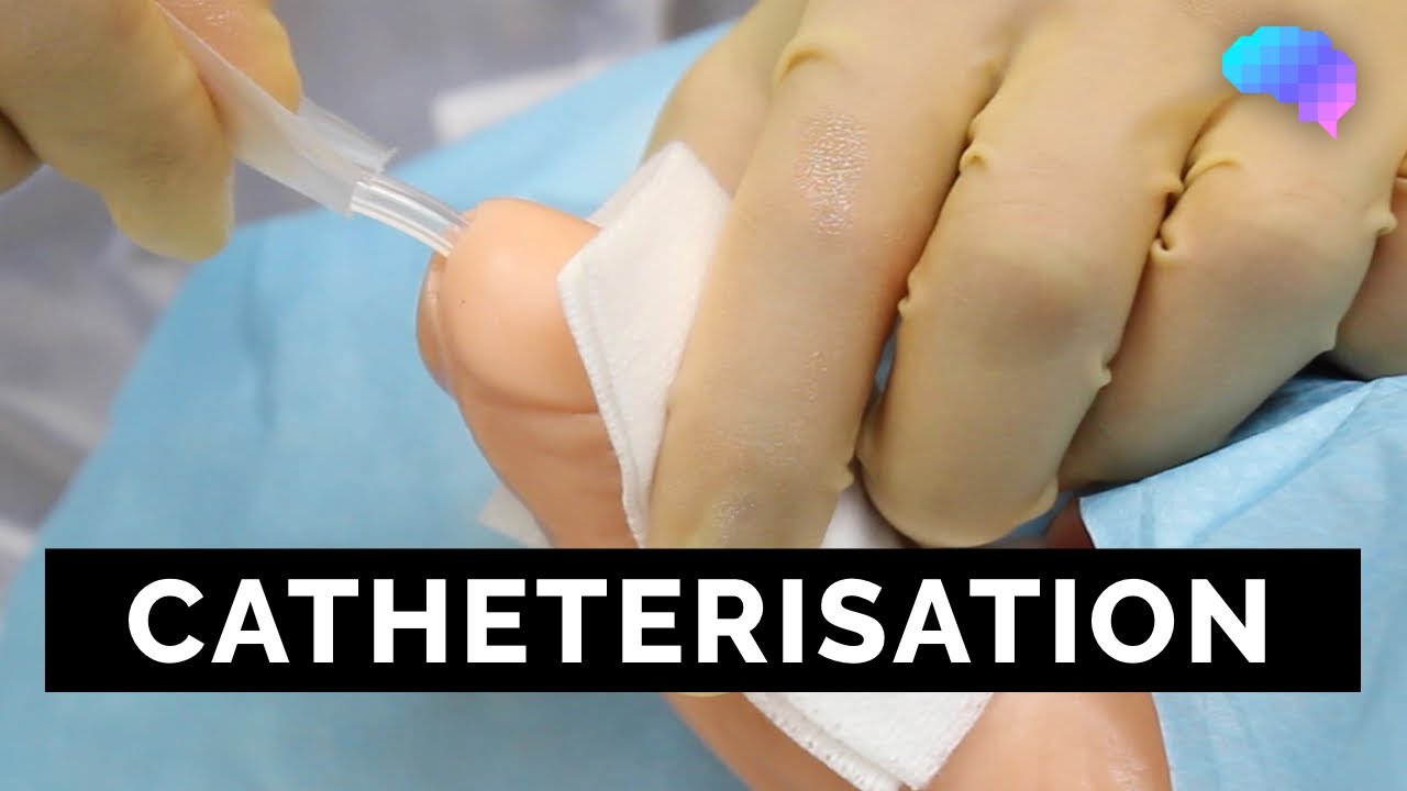 Catheterisation | OSCE Guide | UKMLA | CPSA | PLAB 2 - YouTube - Latex Katheter Hoe Lang Blijven Zitten