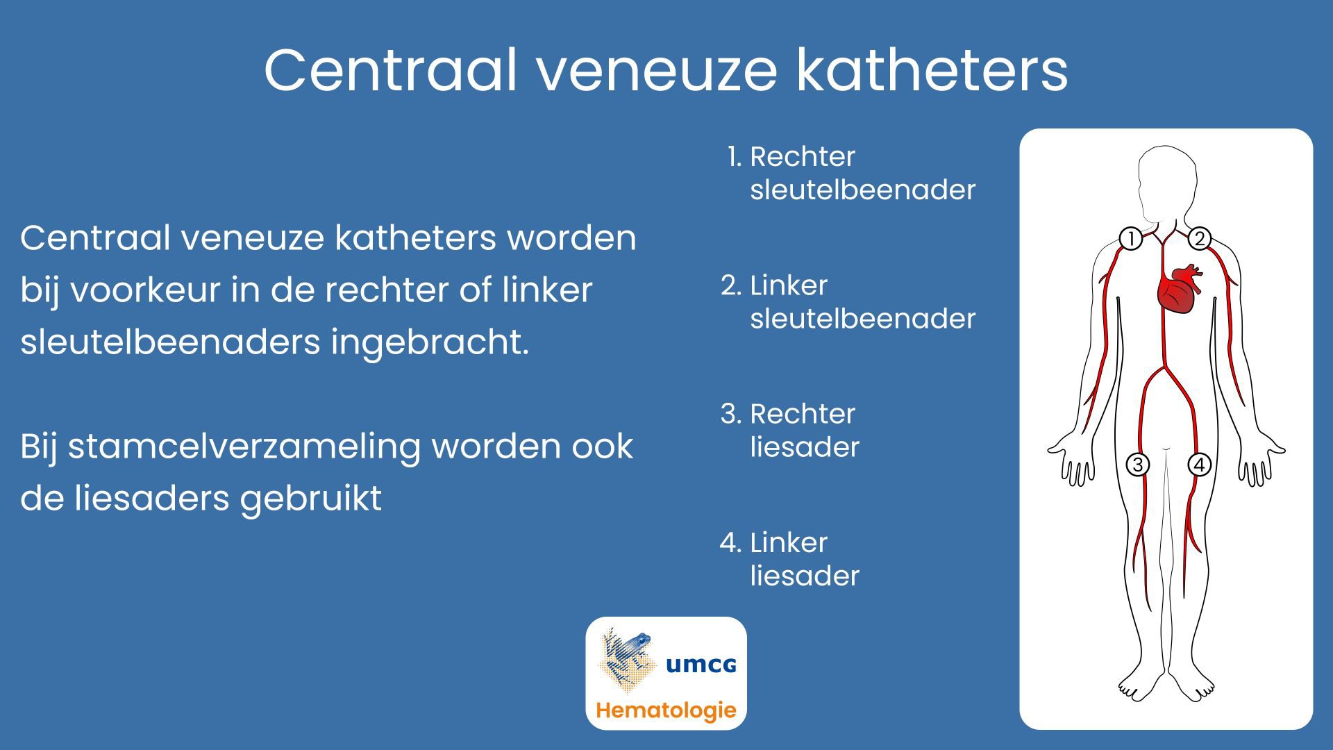 Centraal veneuze katheter - Hematologie Groningen - Welke Vormen Van Katheterisatie Hebben De Voorkeur