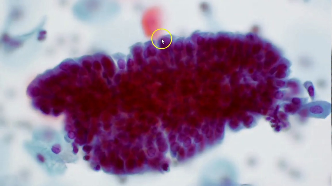 Endocervicale Cylindrische- En Squameus Metaplastische Cellen