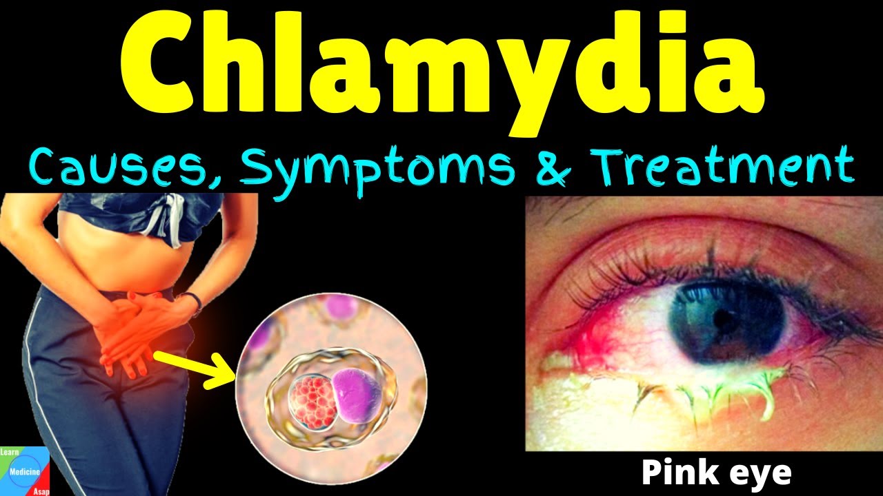 Chlamydia - Symptoms, Causes, Pathophysiology, Diagnosis, Treatment - Kun Je Chlamydia Krijgen Met Condoom
