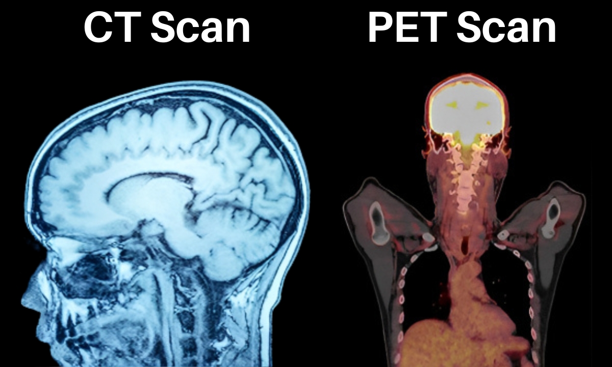 Choosing your Diagnosis: PET Scan VS CT Scan - Kiran Lab - Verschil Mri En Ct Scan En Pet Scan