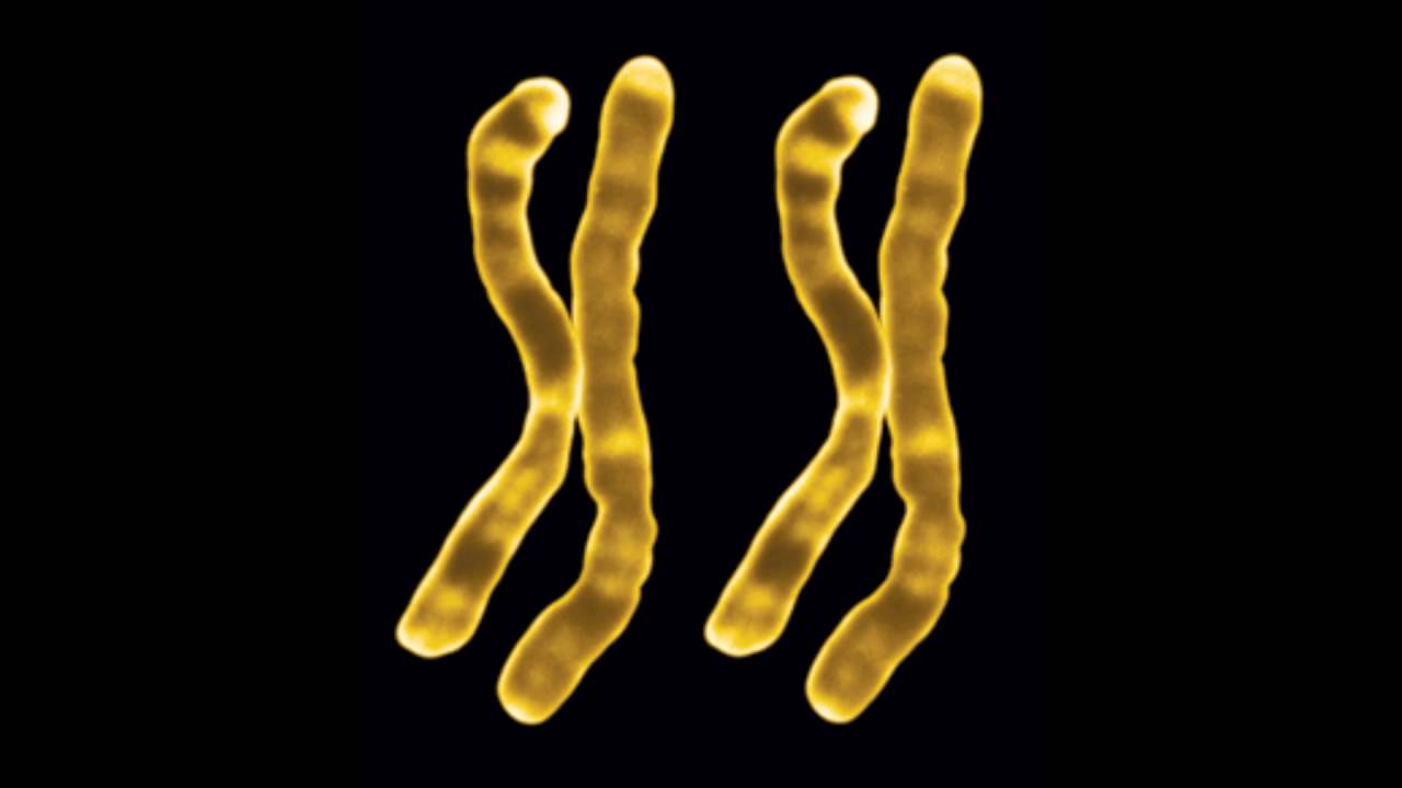 CHROMOSOME TRANSFORMATION Change XY into XX Genetic Female - YouTube - Vrouwen Met Xy Chromosoom Nude