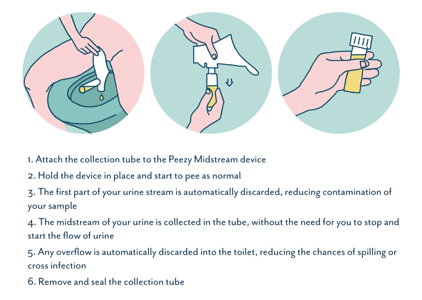 Contamination In Adult Midstream Clean-Catch Urine Cultures, 58% OFF - Mengflora Urine Wat Is Dat