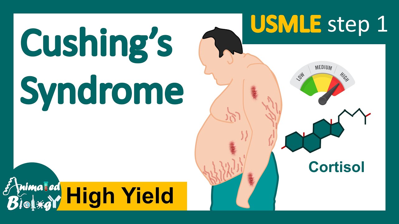 Cushing's syndrome | How is Cushing syndrome diagnosed? | Treatment of - Ziekte Van Cushing En Werken