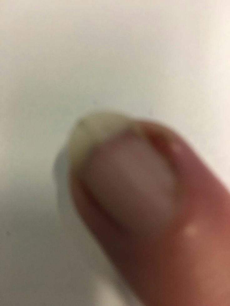 Klopt Als Een Zwerende Vinger