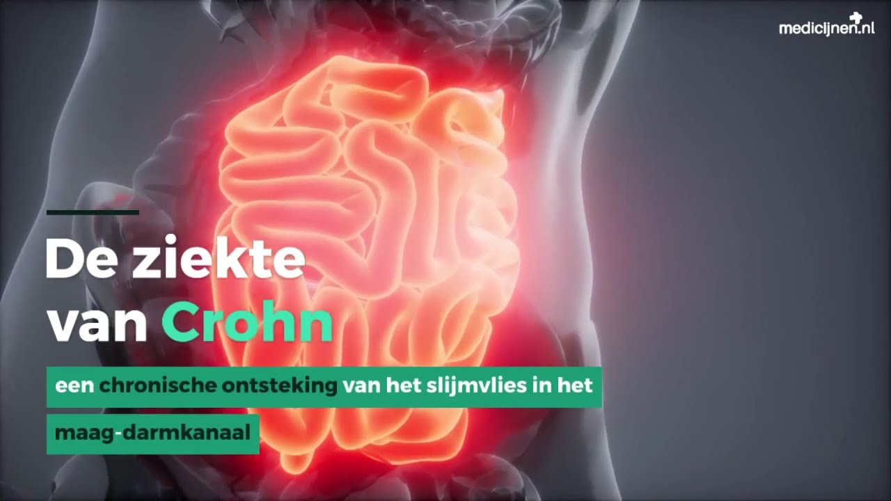 Hoe Begint De Ziekte Ms Meestal