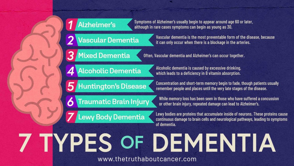 Dementia: Sources, Stages, Symptoms & Solutions - Vormen Van Dementie Lewy Body