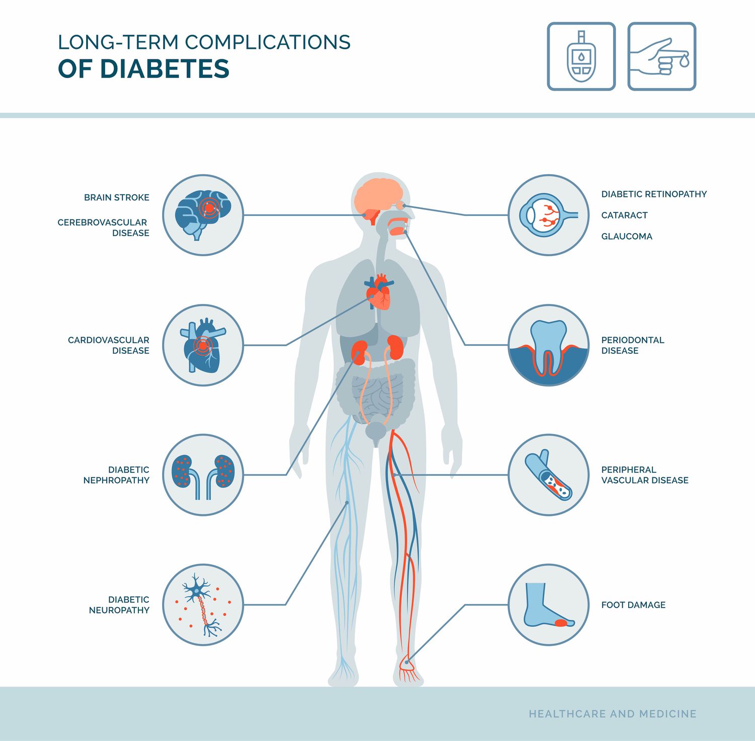 Diabetes Uk - Gevolgen Diabetes Type 1 Lange Termijn