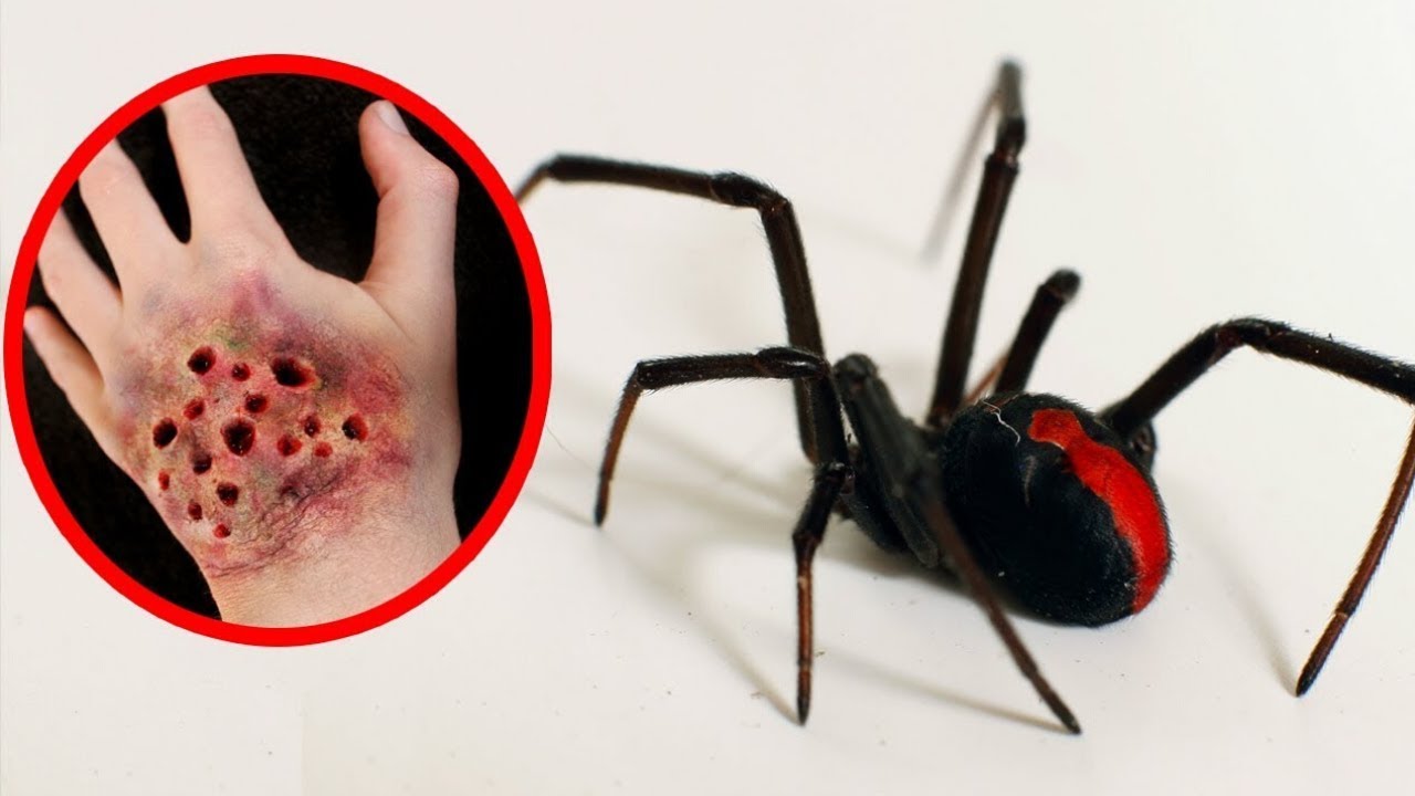 Die 10 gefährlichsten Spinnen der Welt - YouTube - Gevaarlijkste Grootste Spin Ter Wereld