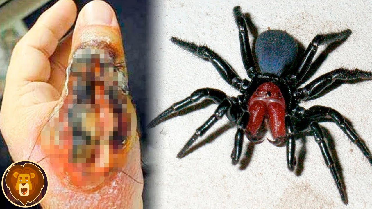 Die 10 giftigsten Spinnenbisse der Welt - YouTube - Waarom Is Een Spin Geen Insect