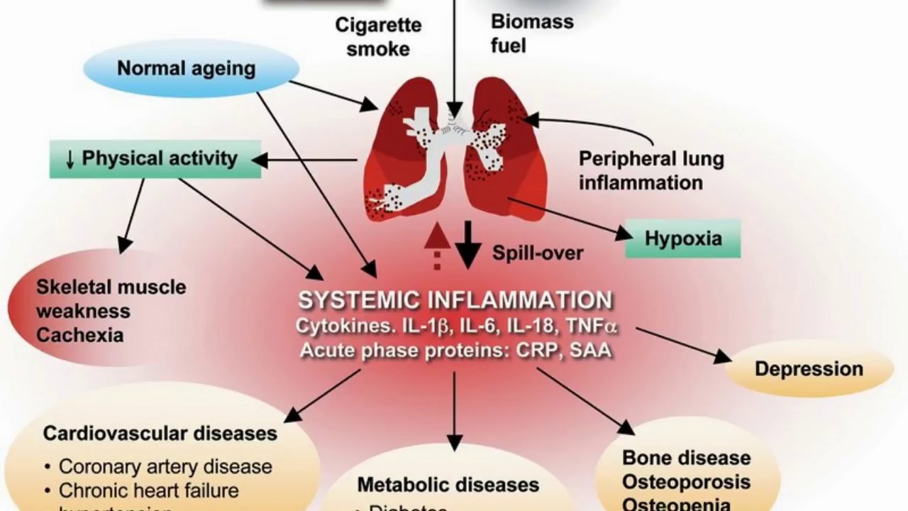Difference Between COPD and Asthma - YouTube - Verschil Astma En Copd Spirometrie
