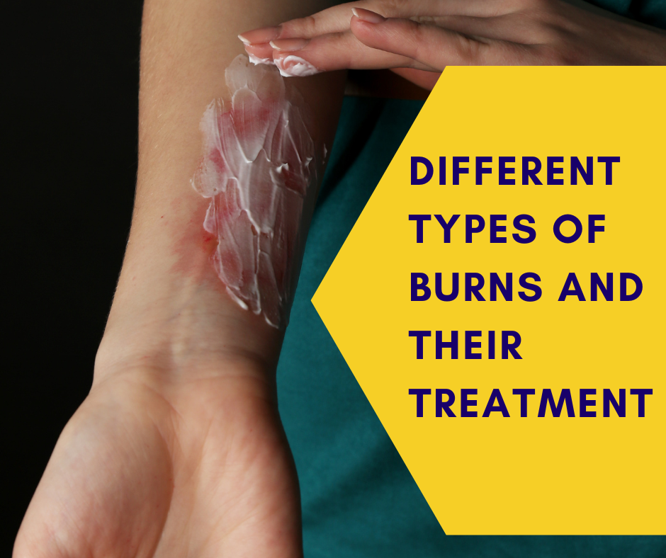 Different Types Of Burns And Their Treatment – CPR AED Certification - Burn Out Of Bore Out