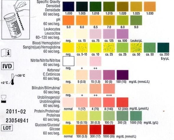 Normaalwaarden Cortisol 24 Uurs Urine