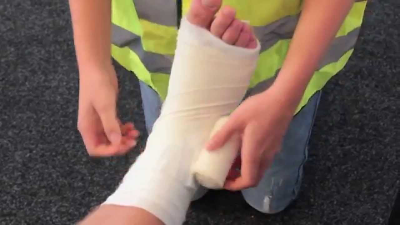 Drukverband enkel - YouTube - Hoe Zwachtel Je Een Been